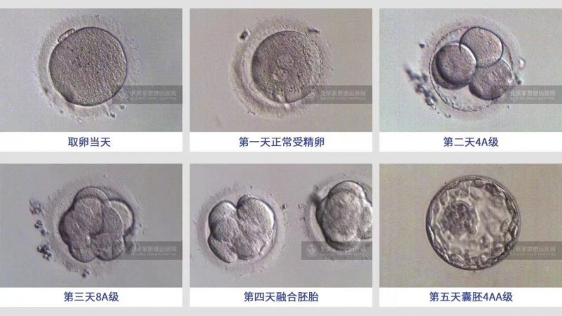 家恩德运:世界罕见病日,遗传检测是预防重中之重(图2) 家恩德运:世界罕见病日,遗传检测是预防重中之重(图2)